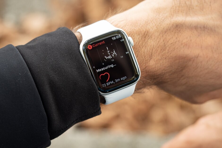 Apple Watch detected what a resting ECG couldn't, saved the life of a doctor